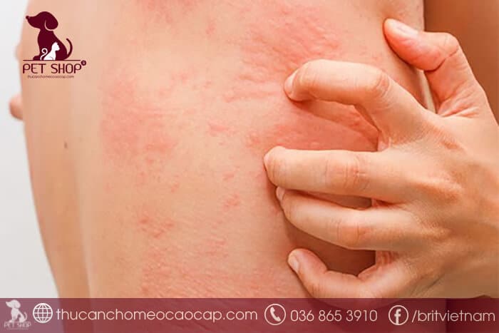 Bệnh sán chó và các thể thường gặp Bệnh sán chó và các thể thường gặp